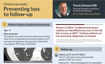 Optellum-Atrium-Health-preventing-loss-to-follow-up-case-study-724x1024-1