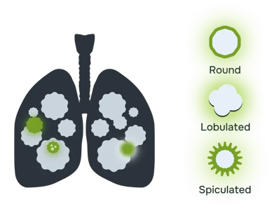 preview-lung-nodules-1