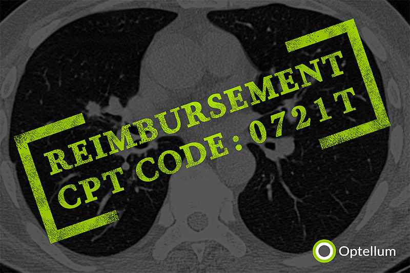 PRESS RELEASE: CMS assigns new technology payment classification for Optellum's Lung Cancer Prediction score