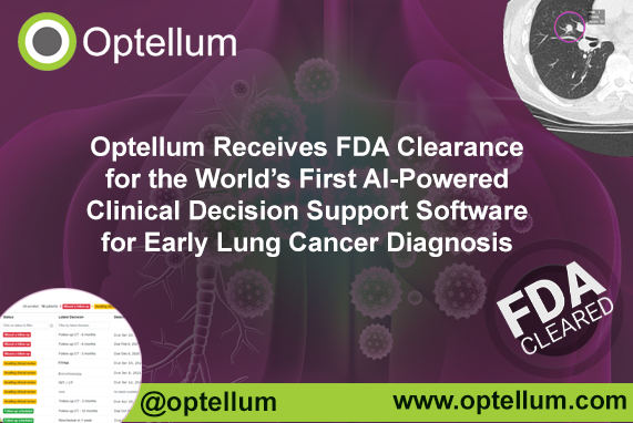 US PRESS RELEASE: Optellum Receives FDA Clearance for the World&rsquo;s First AI-Powered Clinical Decision Support Software for Early Lung Cancer Diagnosis