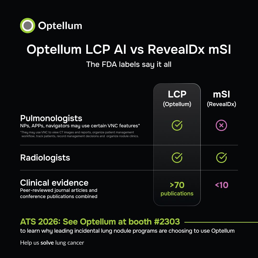 Lung nodule care doesn't stop at the radiology report. So why should the AI?
