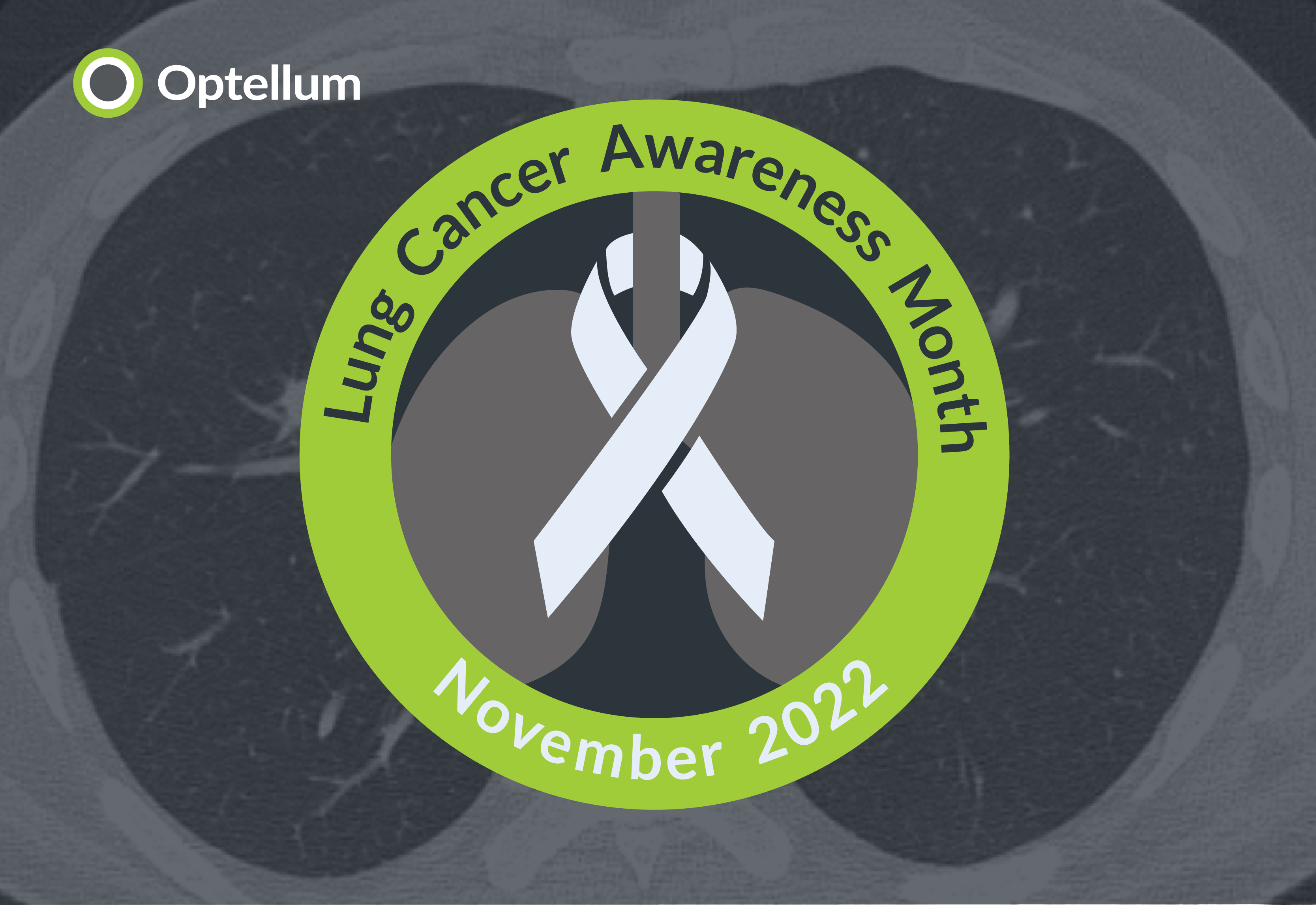 Lung Cancer Awareness Month: Optellum&rsquo;s AI platform demonstrates a vital role in efficient diagnosis to improve lung cancer survival rates