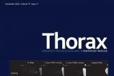 Optellum&rsquo;s lung cancer prediction AI is clinically validated in Thorax