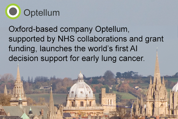 PRESS RELEASE: UK health tech company, goes global with breakthrough in early lung cancer diagnosis AI technology