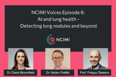 Read more about the article NCIMI voices podcast: AI and lung health