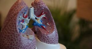 Read more about the article Top Story GE Healthcare, Optellum partner up for AI-driven lung cancer diagnosis