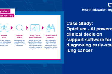 Read more about the article Optellum recognised by the NHS and Health Education England and included as one of two case studies in AI Roadmap report