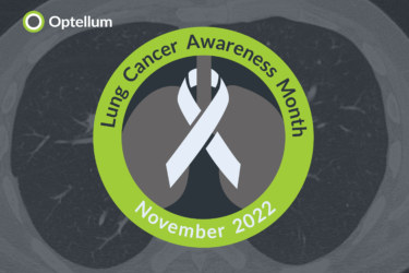Read more about the article Lung Cancer Awareness Month: Optellum’s AI platform demonstrates a vital role in efficient diagnosis to improve lung cancer survival rates